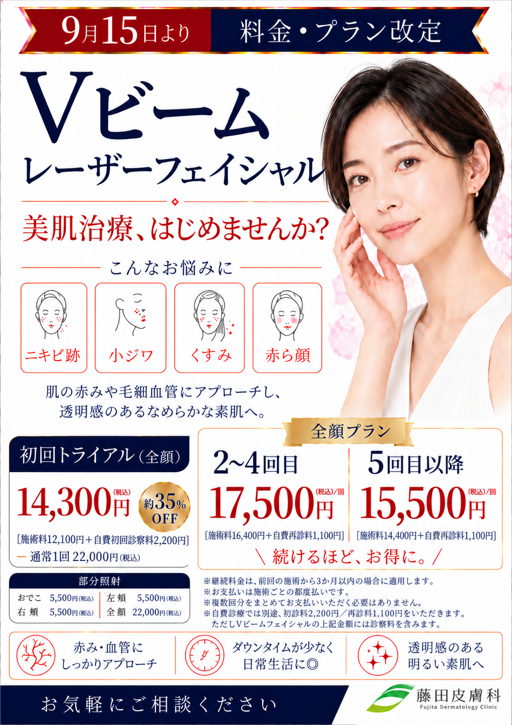 Vbeam（Vビーム）都度払いキャンペーン